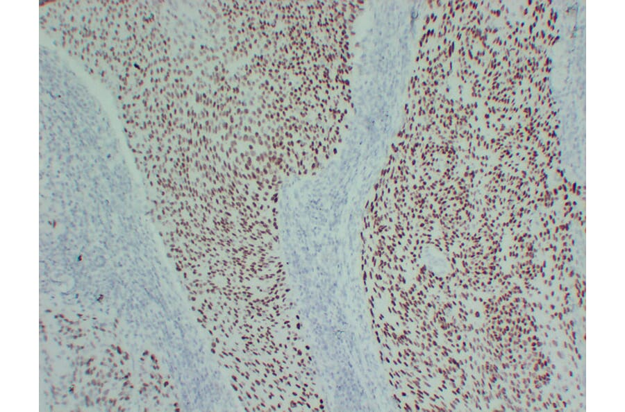 Immunohistochemistry - Anti-p40 Antibody (V0144) - Antibodies.com