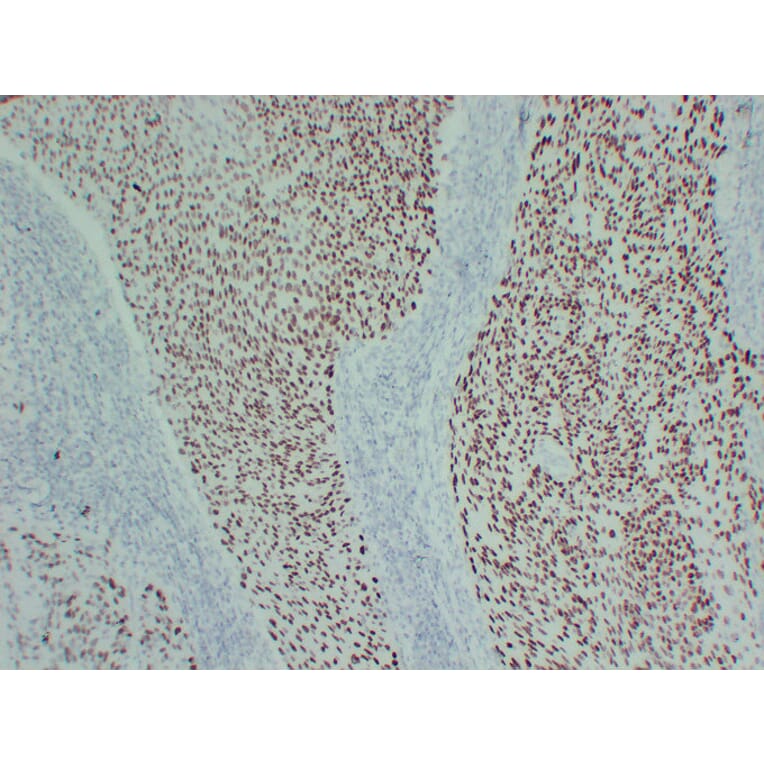 Immunohistochemistry - Anti-p40 Antibody (V0144) - Antibodies.com