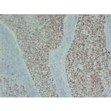 Immunohistochemistry - Anti-p40 Antibody (V0144) - Antibodies.com