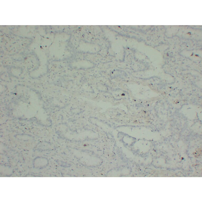 Immunohistochemistry - Anti-p40 Antibody (V0144) - Antibodies.com