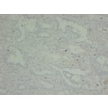 Immunohistochemistry - Anti-p40 Antibody (V0144) - Antibodies.com