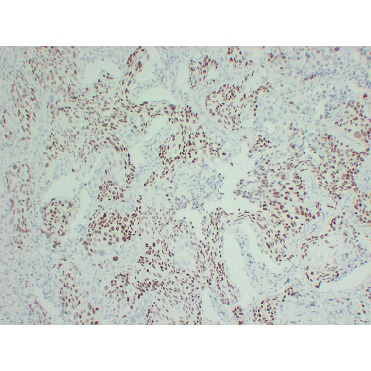 Immunohistochemistry - Anti-p40 Antibody (V0144) - Antibodies.com