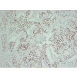 Immunohistochemistry - Anti-p40 Antibody (V0144) - Antibodies.com