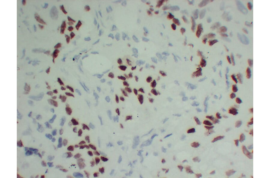Immunohistochemistry - Anti-p40 Antibody (V0144) - Antibodies.com