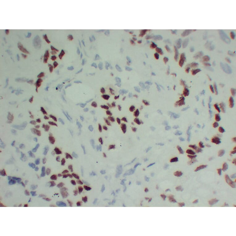 Immunohistochemistry - Anti-p40 Antibody (V0144) - Antibodies.com