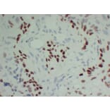 Immunohistochemistry - Anti-p40 Antibody (V0144) - Antibodies.com