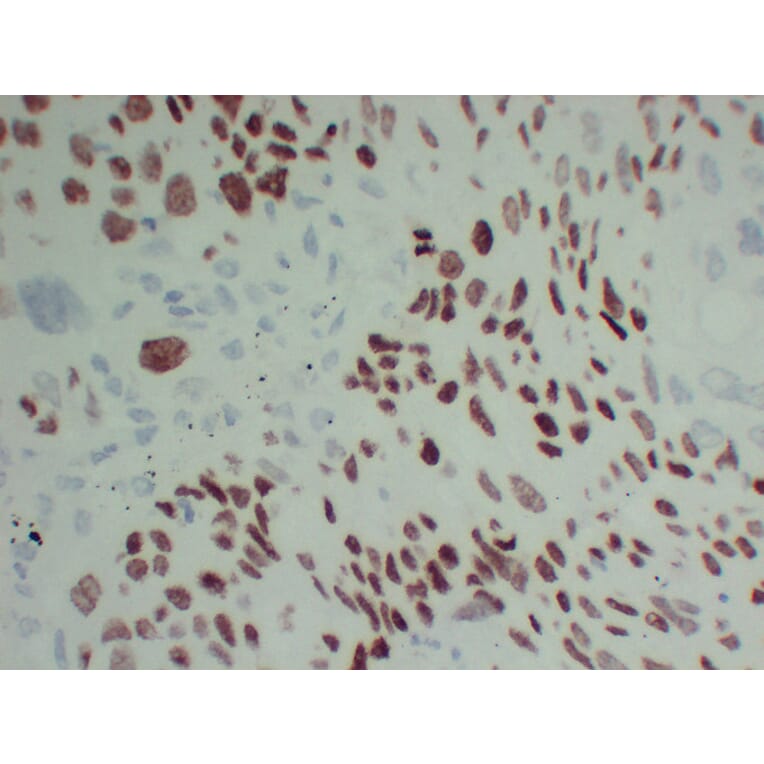 Immunohistochemistry - Anti-p40 Antibody (V0144) - Antibodies.com