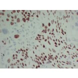 Immunohistochemistry - Anti-p40 Antibody (V0144) - Antibodies.com