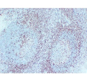 Immunohistochemistry - Anti-CD5 Antibody (V0030) - Antibodies.com