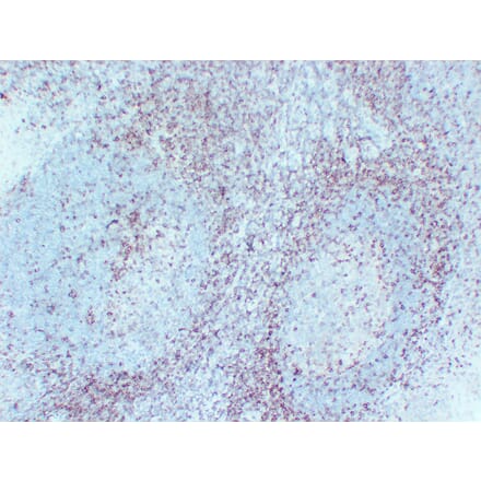 Immunohistochemistry - Anti-CD5 Antibody (V0030) - Antibodies.com