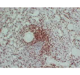 Immunohistochemistry - Anti-CD3 Antibody (V0026) - Antibodies.com