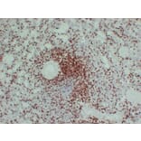 Immunohistochemistry - Anti-CD3 Antibody (V0026) - Antibodies.com