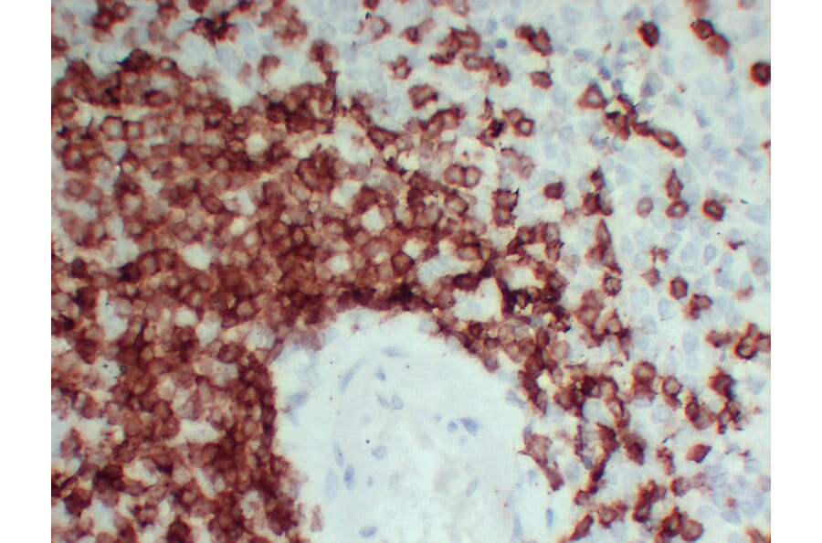 Immunohistochemistry - Anti-CD3 Antibody (V0026) - Antibodies.com