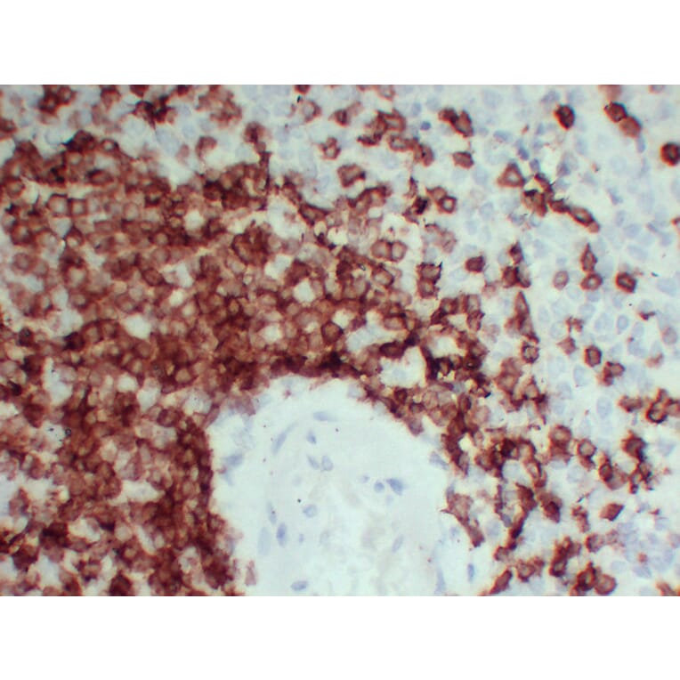 Immunohistochemistry - Anti-CD3 Antibody (V0026) - Antibodies.com