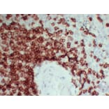 Immunohistochemistry - Anti-CD3 Antibody (V0026) - Antibodies.com