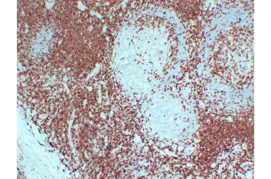 Immunohistochemistry - Anti-CD3 Antibody (V0026) - Antibodies.com
