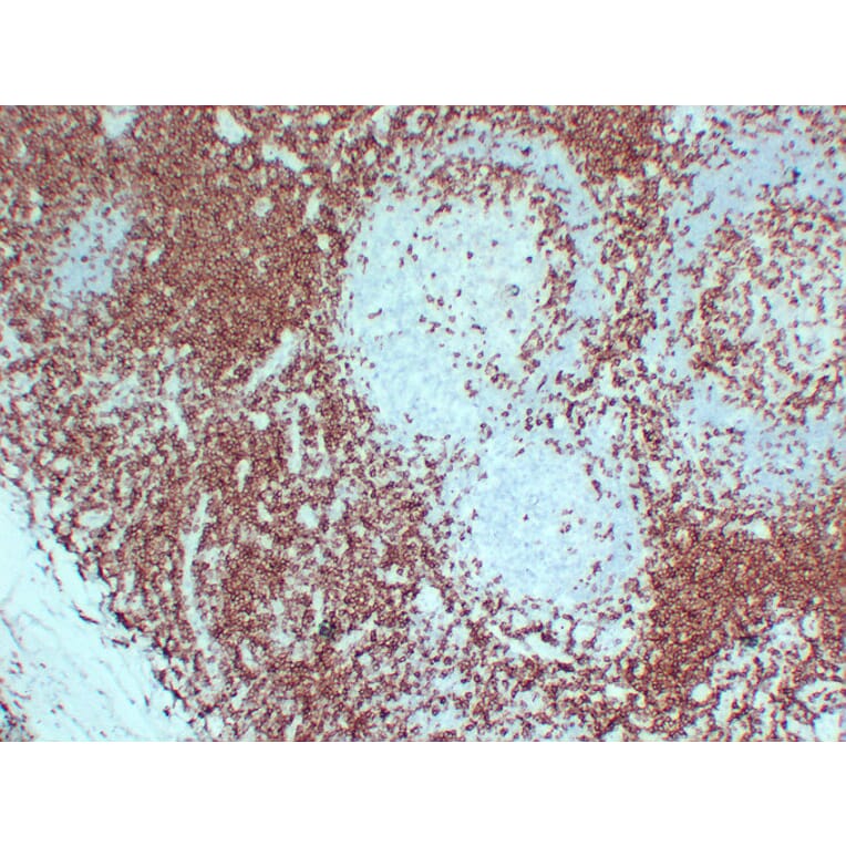 Immunohistochemistry - Anti-CD3 Antibody (V0026) - Antibodies.com