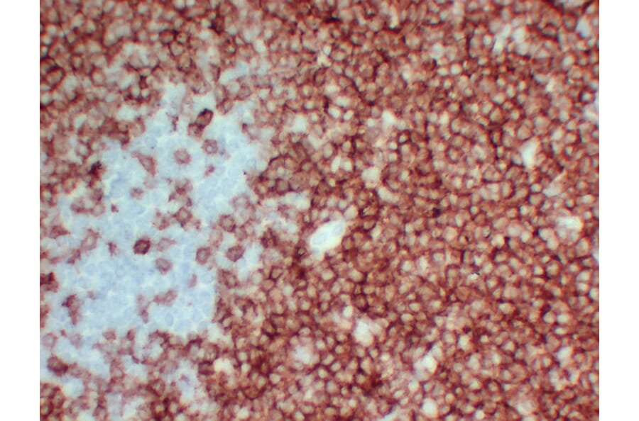Immunohistochemistry - Anti-CD3 Antibody (V0026) - Antibodies.com