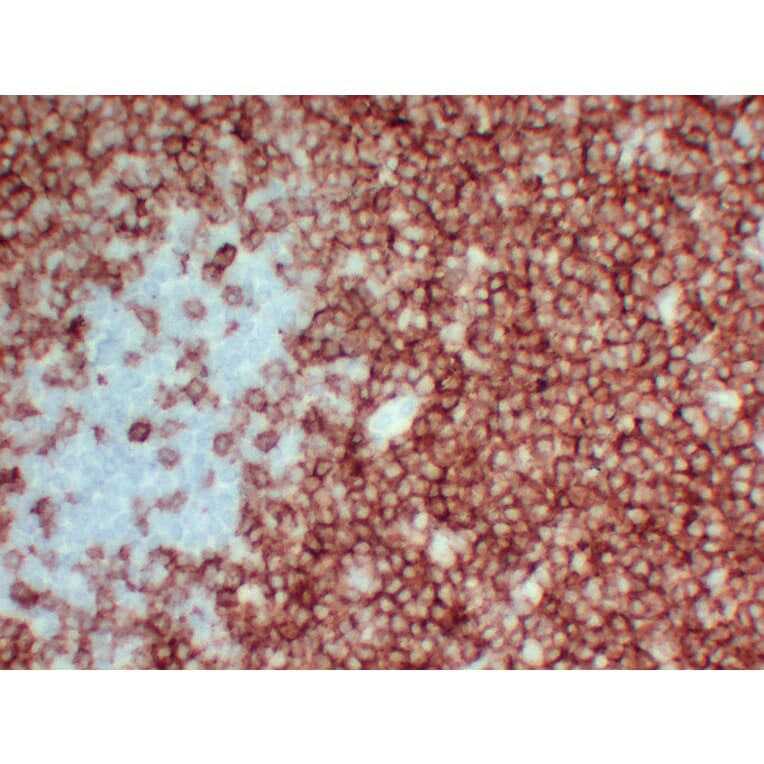 Immunohistochemistry - Anti-CD3 Antibody (V0026) - Antibodies.com