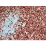 Immunohistochemistry - Anti-CD3 Antibody (V0026) - Antibodies.com