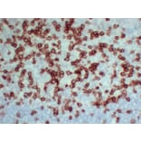 Immunohistochemistry - Anti-CD3 Antibody (V0026) - Antibodies.com