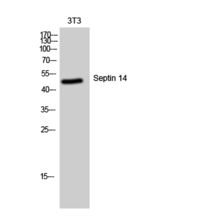 Western Blot - Anti-SEPT14 Antibody (C18508) - Antibodies.com