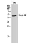 Western Blot - Anti-SEPT14 Antibody (C18508) - Antibodies.com