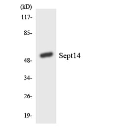 Western Blot - Anti-SEPT14 Antibody (R12-3488) - Antibodies.com