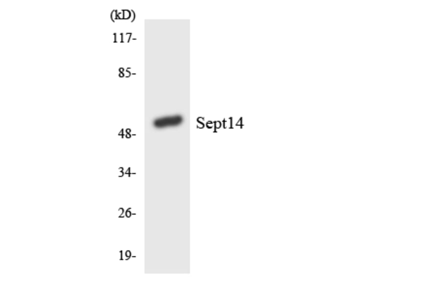Western Blot - Anti-SEPT14 Antibody (R12-3488) - Antibodies.com