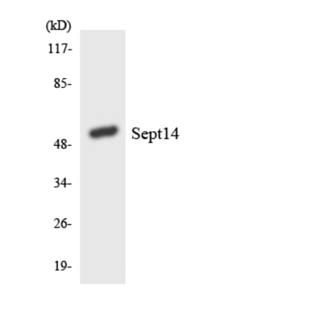 Western Blot - Anti-SEPT14 Antibody (R12-3488) - Antibodies.com