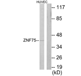 Western Blot - Anti-ZNF75 Antibody (C10689) - Antibodies.com