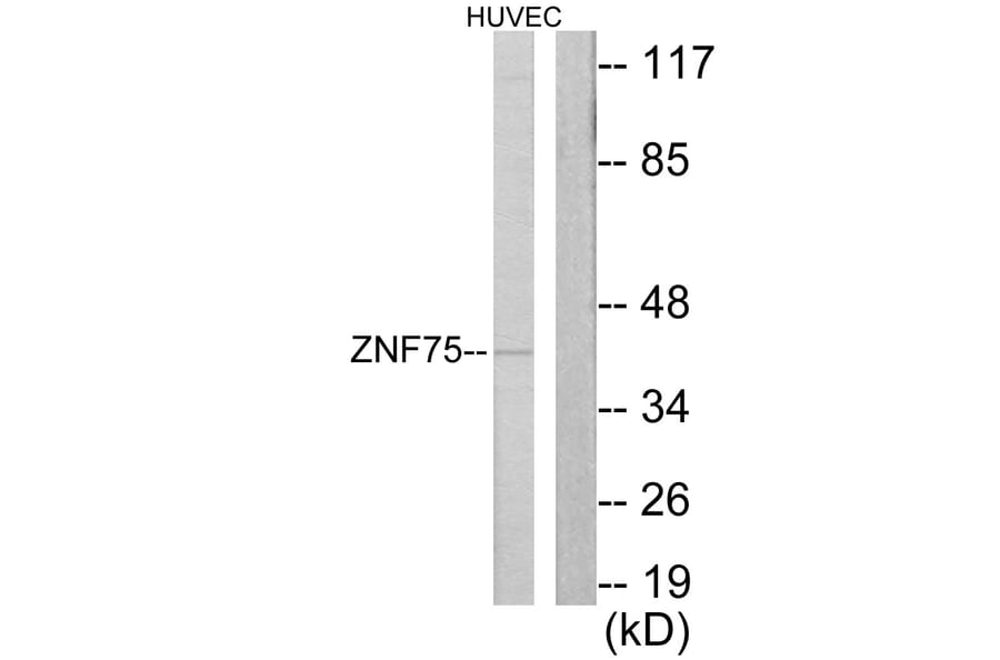 Western Blot - Anti-ZNF75 Antibody (C10689) - Antibodies.com