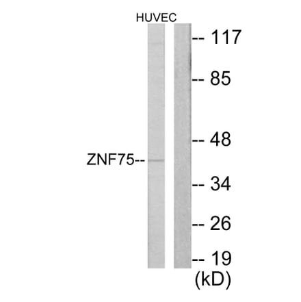 Western Blot - Anti-ZNF75 Antibody (C10689) - Antibodies.com