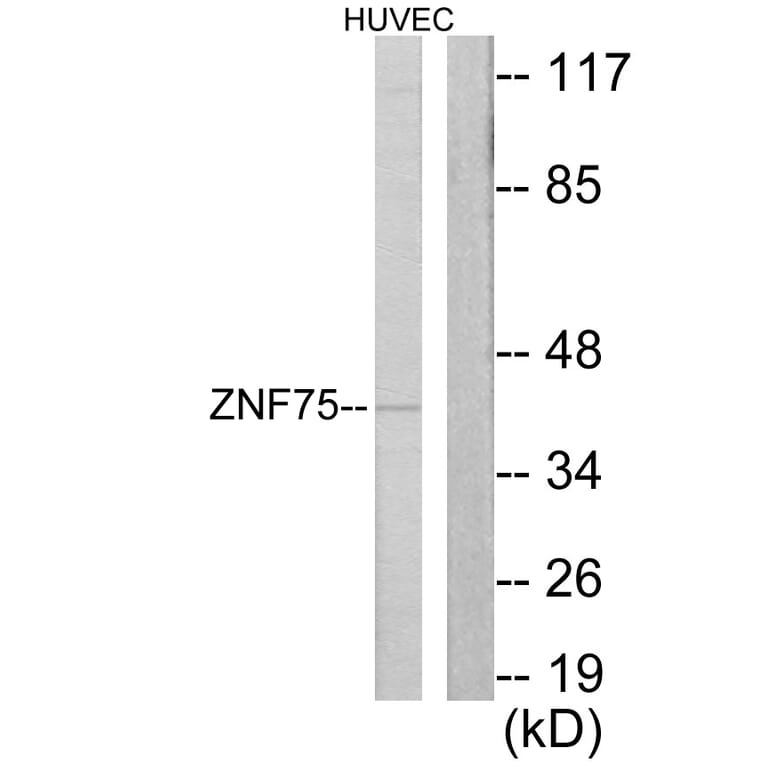 Western Blot - Anti-ZNF75 Antibody (C10689) - Antibodies.com