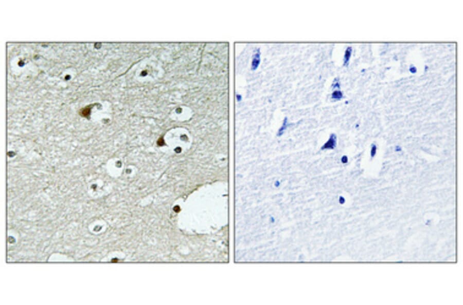 Immunohistochemistry - Anti-ZNF75 Antibody (C10689) - Antibodies.com