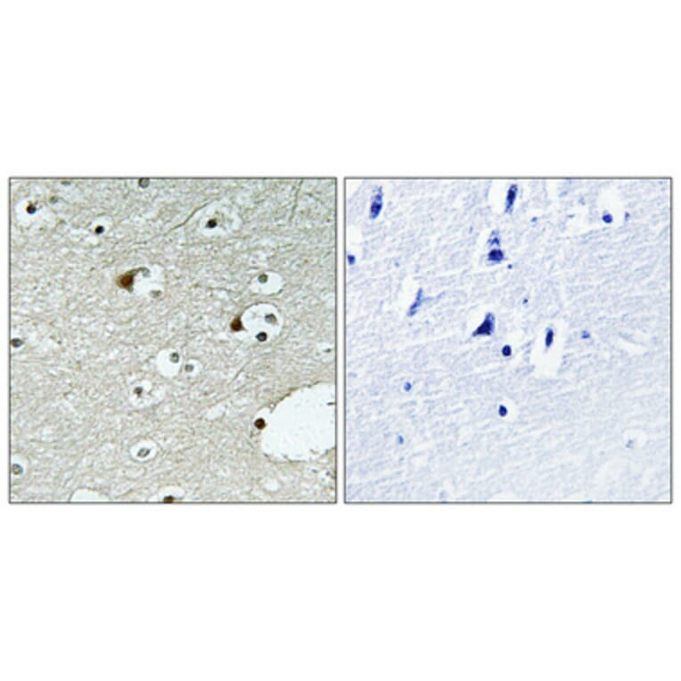 Immunohistochemistry - Anti-ZNF75 Antibody (C10689) - Antibodies.com