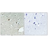 Immunohistochemistry - Anti-ZNF75 Antibody (C10689) - Antibodies.com