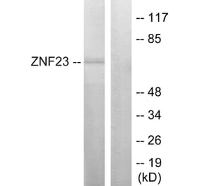Western Blot - Anti-ZNF23 Antibody (C10396) - Antibodies.com