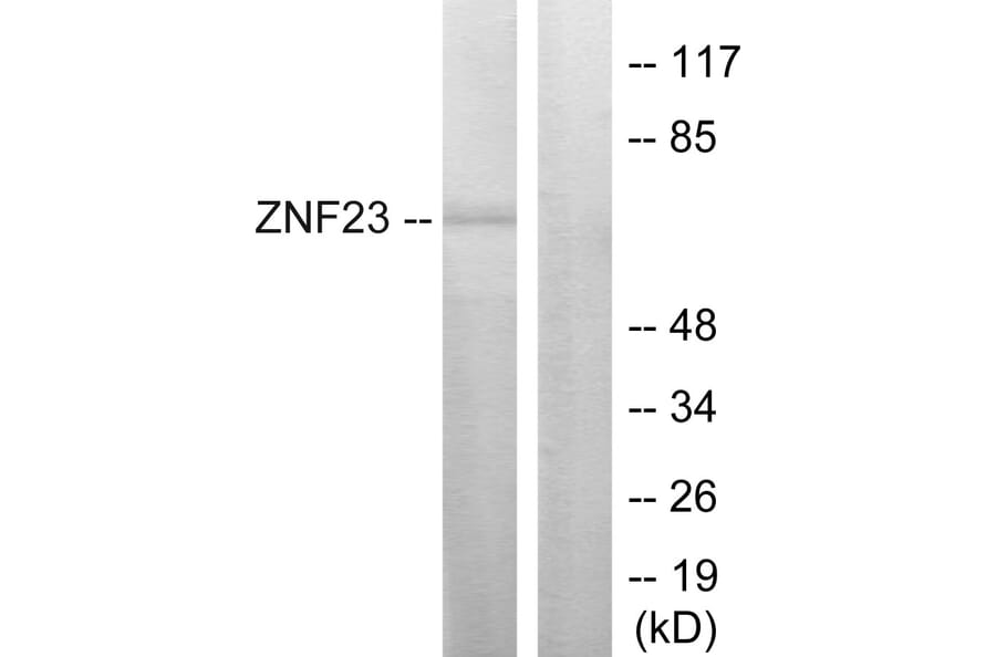 Western Blot - Anti-ZNF23 Antibody (C10396) - Antibodies.com