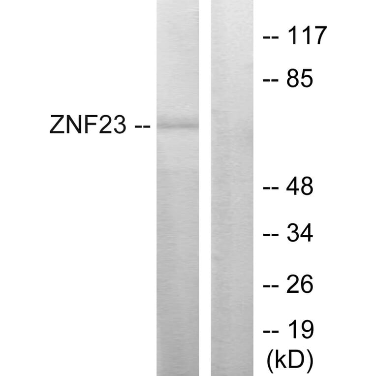 Western Blot - Anti-ZNF23 Antibody (C10396) - Antibodies.com
