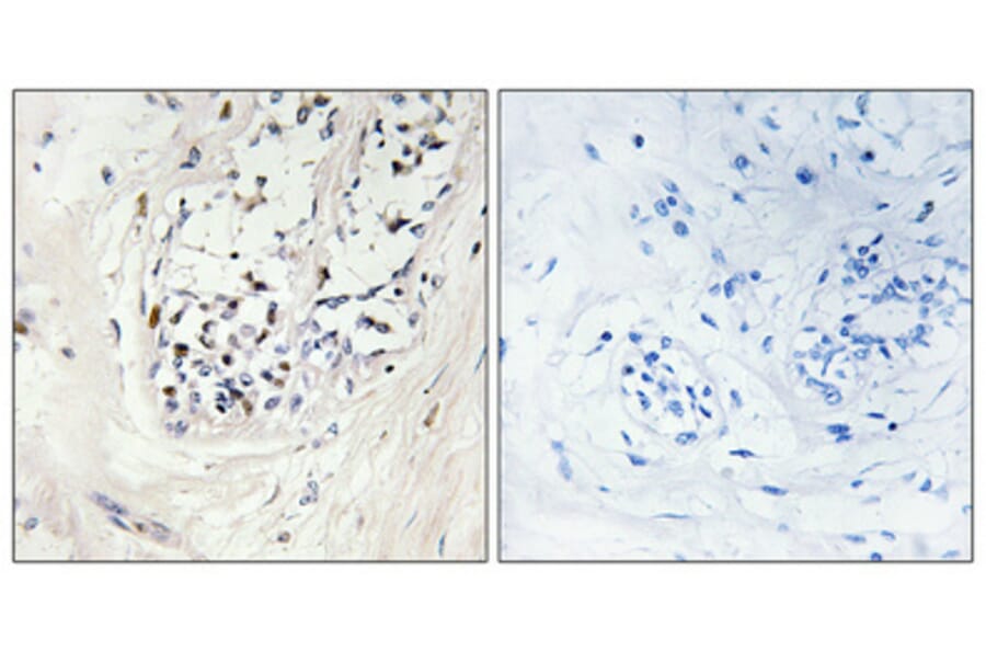 Immunohistochemistry - Anti-ZNF23 Antibody (C10396) - Antibodies.com