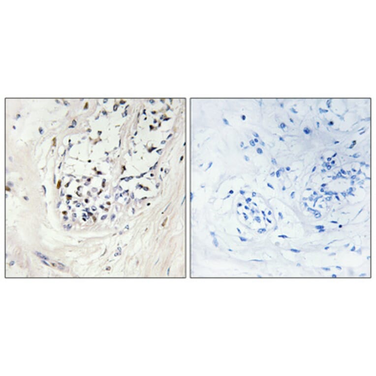 Immunohistochemistry - Anti-ZNF23 Antibody (C10396) - Antibodies.com