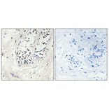 Immunohistochemistry - Anti-ZNF23 Antibody (C10396) - Antibodies.com