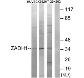 Western Blot - Anti-ZADH1 Antibody (C19633) - Antibodies.com
