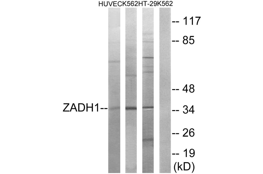 Western Blot - Anti-ZADH1 Antibody (C19633) - Antibodies.com
