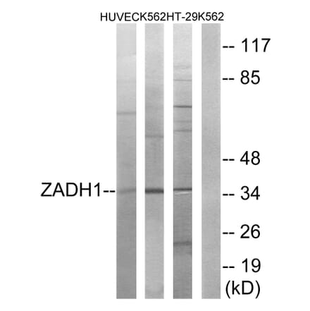 Western Blot - Anti-ZADH1 Antibody (C19633) - Antibodies.com