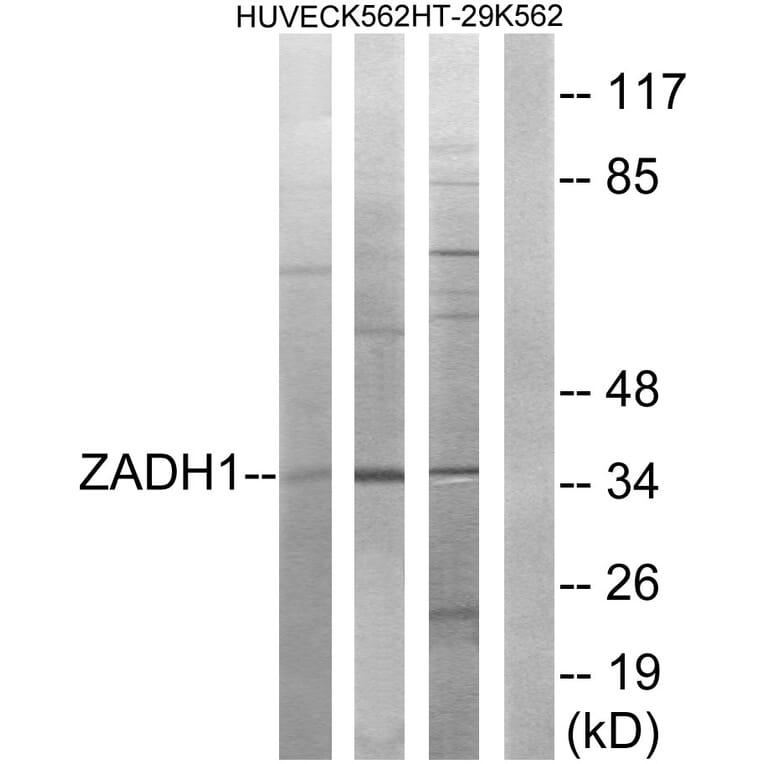 Western Blot - Anti-ZADH1 Antibody (C19633) - Antibodies.com