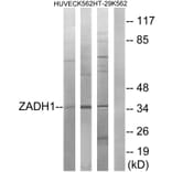 Western Blot - Anti-ZADH1 Antibody (C19633) - Antibodies.com