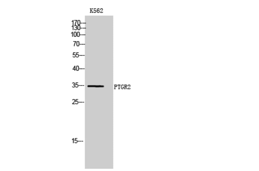 Western Blot - Anti-ZADH1 Antibody (C19633) - Antibodies.com