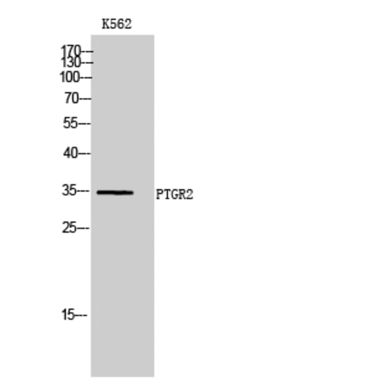 Western Blot - Anti-ZADH1 Antibody (C19633) - Antibodies.com